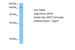 MYO6 Rabbit anti-Human, Polyclonal, Novus Biologicals 0.1ml; Unconjugated:Antibodies,